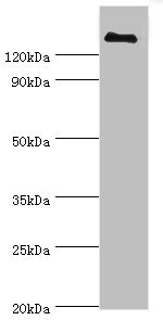 CFH / Complement Factor H Antibody - Western blot All lanes: CFH antibody at 3µg/ml + human serum Secondary Goat polyclonal to rabbit IgG at 1/10000 dilution Predicted band size: 140, 52 kDa Observed band size: 140 kDa