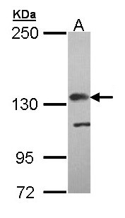 CFH / Complement Factor H Antibody - Sample (30 ug of whole cell lysate). A: Molt-4 . 5% SDS PAGE. CFH / Factor H antibody diluted at 1:5000.