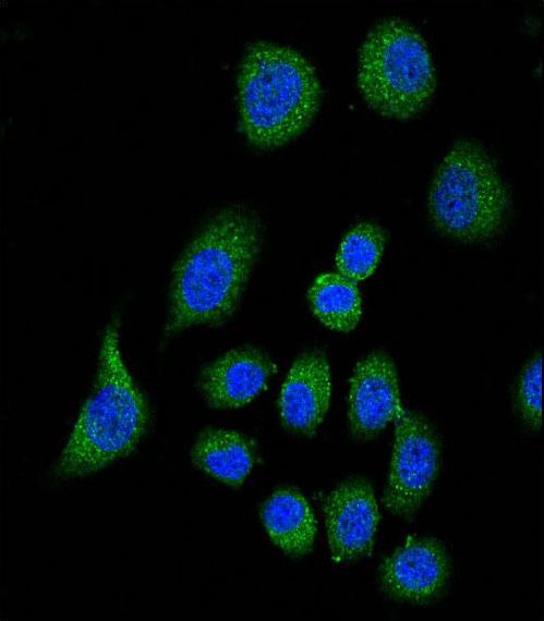 CFH / Complement Factor H Antibody - Confocal immunofluorescence of CFH Antibody with A549 cell followed by Alexa Fluor 489-conjugated goat anti-rabbit lgG (green). DAPI was used to stain the cell nuclear (blue).