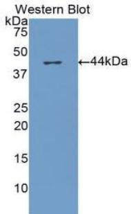 CFH / Complement Factor H Antibody - Western blot of recombinant CFH / Complement Factor H.  This image was taken for the unconjugated form of this product. Other forms have not been tested.