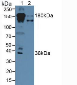 CFH / Complement Factor H Antibody - Western Blot; Sample: Lane1: Human Serum; Lane2: Human Liver Tissue.