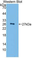 CFH / Complement Factor H Antibody