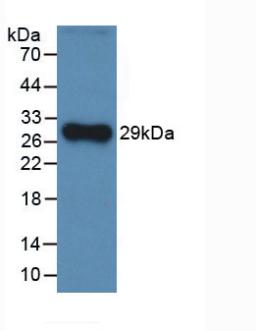CFH / Complement Factor H Antibody