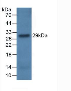 CFH / Complement Factor H Antibody