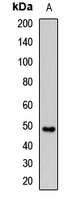 CFH / Complement Factor H Antibody