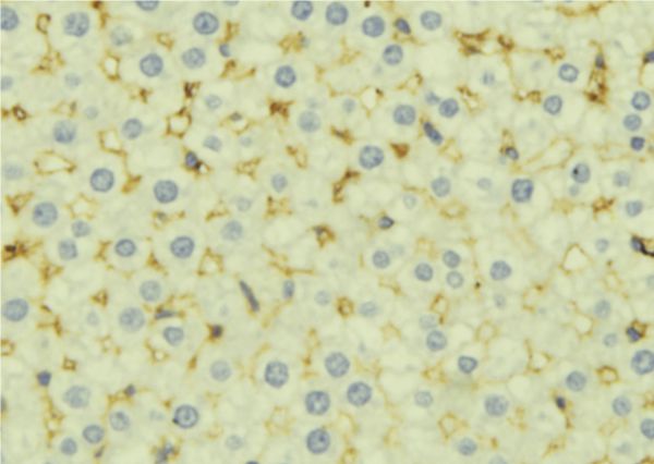 CFH / Complement Factor H Antibody - 1:100 staining mouse liver tissue by IHC-P. The sample was formaldehyde fixed and a heat mediated antigen retrieval step in citrate buffer was performed. The sample was then blocked and incubated with the antibody for 1.5 hours at 22°C. An HRP conjugated goat anti-rabbit antibody was used as the secondary.