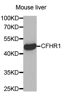 CFHR1 Antibody - Western blot analysis of extracts of Mouse liver tissue.