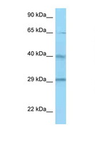 CFHR1 Antibody - CFHR1 / CFHL1 antibody Western blot of ACHN Cell lysate. Antibody concentration 1 ug/ml.  This image was taken for the unconjugated form of this product. Other forms have not been tested.