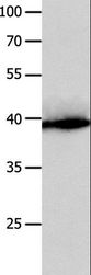 CFHR1 Antibody - Western blot analysis of Human liver cancer tissue, using CFHR1 Polyclonal Antibody at dilution of 1:300.