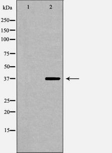 CFHR1 Antibody - Western blot analysis of extracts of HepG2 cells using CFHR1 antibody. The lane on the left is treated with the antigen-specific peptide.