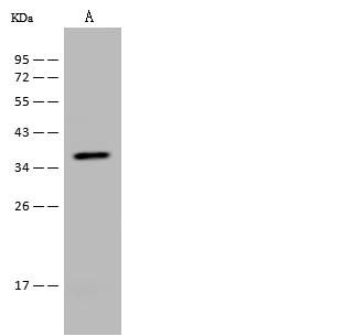 CFHR1 Antibody - Anti-CFHR1 rabbit polyclonal antibody at 1:500 dilution. Lane A: A549 Whole Cell Lysate. Lysates/proteins at 30 ug per lane. Secondary: Goat Anti-Rabbit IgG (H+L)/HRP at 1/10000 dilution. Developed using the ECL technique. Performed under reducing conditions. Predicted band size: 38 kDa. Observed band size: 38 kDa.