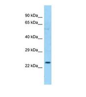 CFHR2 Antibody - Western blot of Human OVCAR-3. CFHR2 antibody dilution 1.0 ug/ml.  This image was taken for the unconjugated form of this product. Other forms have not been tested.