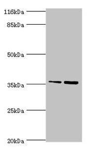 CFHR2 Antibody - Western blot All lanes: CFHR2 antibody at 2µg/ml Lane 1: Hela whole cell lysate Lane 2: 293T whole cell lysate Secondary Goat polyclonal to rabbit IgG at 1/10000 dilution Predicted band size: 31, 28 kDa Observed band size: 36 kDa