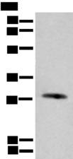 CFHR2 Antibody - Western blot analysis of Human urinary bladder tissue lysate  using CFHR2 Polyclonal Antibody at dilution of 1:550