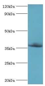 CFHR3 / CFHL3 Antibody - Western blot. All lanes: Complement factor H-related protein 3 antibody at 6 ug/ml+rat heart tissue. Secondary antibody: Goat polyclonal to rabbit at 1:10000 dilution. Predicted band size: 37 kDa. Observed band size: 37 kDa.