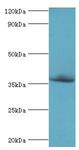 CFHR3 / CFHL3 Antibody - Western blot. All lanes: Complement factor H-related protein 3 antibody at 6 ug/ml+rat heart tissue. Secondary antibody: Goat polyclonal to rabbit at 1:10000 dilution. Predicted band size: 37 kDa. Observed band size: 37 kDa.