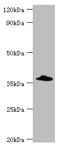 CFHR3 / CFHL3 Antibody - Western blot All lanes: Complement factor H-related protein 3 antibody at 6µg/ml + Rat heart tissue Secondary Goat polyclonal to rabbit IgG at 1/10000 dilution Predicted band size: 38, 31 kDa Observed band size: 38 kDa
