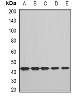 CFHR3 / CFHL3 Antibody - Western blot analysis of FHR3 expression in A549 (A); HepG2 (B); NIH3T3 (C); mouse liver (D); rat liver (E) whole cell lysates.