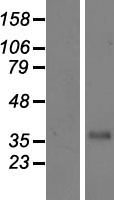 CFHR3 / CFHL3 Protein - Western validation with an anti-DDK antibody * L: Control HEK293 lysate R: Over-expression lysate