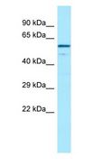 CFHR4 Antibody - CFHR4 antibody Western Blot of Placenta.  This image was taken for the unconjugated form of this product. Other forms have not been tested.