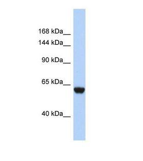 CFHR4 Antibody - Western blot of Human 721_B. FHR4 antibody dilution 1.0 ug/ml.  This image was taken for the unconjugated form of this product. Other forms have not been tested.