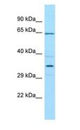 CFHR5 Antibody - CFHR5 antibody Western Blot of THP-1.  This image was taken for the unconjugated form of this product. Other forms have not been tested.