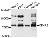 CFHR5 Antibody - Western blot analysis of extracts of various cell lines, using CFHR5 antibody at 1:1000 dilution. The secondary antibody used was an HRP Goat Anti-Rabbit IgG (H+L) at 1:10000 dilution. Lysates were loaded 25ug per lane and 3% nonfat dry milk in TBST was used for blocking. An ECL Kit was used for detection and the exposure time was 3s.