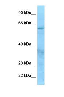 CFI / Complement Factor I Antibody - CFI / Factor I antibody Western blot of HeLa Cell lysate. Antibody concentration 1 ug/ml.  This image was taken for the unconjugated form of this product. Other forms have not been tested.
