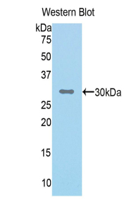 CFI / Complement Factor I Antibody - Western blot of recombinant CFI / Complement Factor I.  This image was taken for the unconjugated form of this product. Other forms have not been tested.