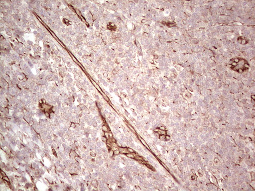 CFI / Complement Factor I Antibody - IHC of paraffin-embedded Human tonsil using anti-CFI mouse monoclonal antibody. (Heat-induced epitope retrieval by 1 mM EDTA in 10mM Tris, pH8.5, 120°C for 3min).