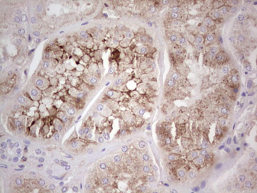 CFI / Complement Factor I Antibody - Immunohistochemical staining of paraffin-embedded Human Kidney tissue within the normal limits using anti-CFI mouse monoclonal antibody.  Dilution: 1:150