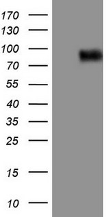 CFI / Complement Factor I Antibody - HEK293T cells were transfected with the pCMV6-ENTRY control (Left lane) or pCMV6-ENTRY CFI (Right lane) cDNA for 48 hrs and lysed. Equivalent amounts of cell lysates (5 ug per lane) were separated by SDS-PAGE and immunoblotted with anti-CFI.