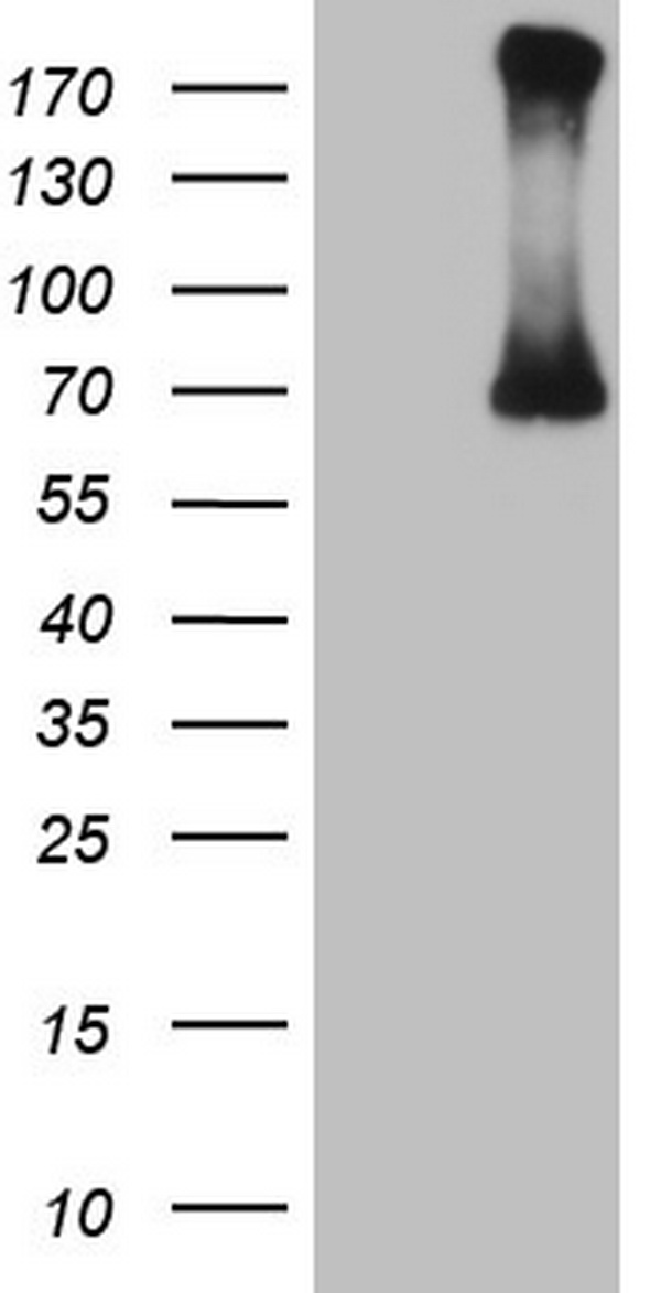 CFI / Complement Factor I Antibody - HEK293T cells were transfected with the pCMV6-ENTRY control. (Left lane) or pCMV6-ENTRY CFI. (Right lane) cDNA for 48 hrs and lysed. Equivalent amounts of cell lysates. (5 ug per lane) were separated by SDS-PAGE and immunoblotted with anti-CFI.