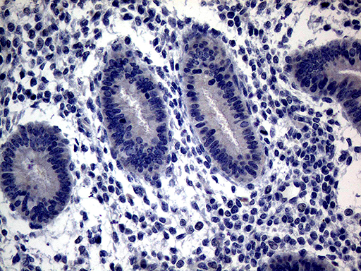 CFI / Complement Factor I Antibody - Immunohistochemical staining of paraffin-embedded Human endometrium tissue within the normal limits using anti-CFI mouse monoclonal antibody. (Heat-induced epitope retrieval by 1mM EDTA in 10mM Tris buffer. (pH8.5) at 120°C for 3 min. (1:2000)