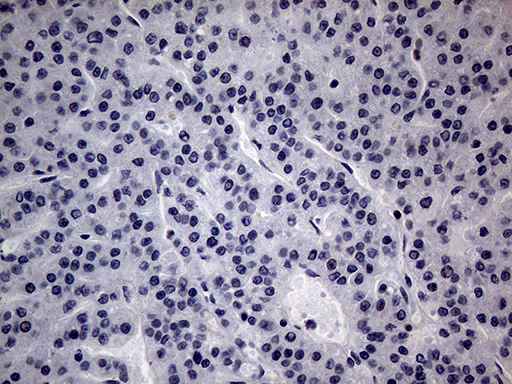 CFI / Complement Factor I Antibody - Immunohistochemical staining of paraffin-embedded Human liver tissue within the normal limits using anti-CFI mouse monoclonal antibody.This figure shows negative staining. (Heat-induced epitope retrieval by 1mM EDTA in 10mM Tris buffer. (pH8.5) at 120°C for 3 min. (1:2000)