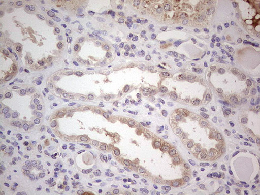 CFI / Complement Factor I Antibody - Immunohistochemical staining of paraffin-embedded Human Kidney tissue within the normal limits using anti-CFI mouse monoclonal antibody.  Dilution: 1:150