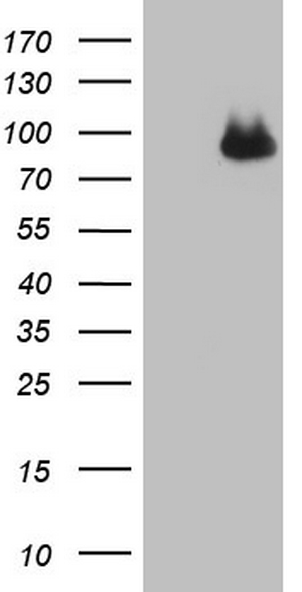CFI / Complement Factor I Antibody - HEK293T cells were transfected with the pCMV6-ENTRY control (Left lane) or pCMV6-ENTRY CFI (Right lane) cDNA for 48 hrs and lysed. Equivalent amounts of cell lysates (5 ug per lane) were separated by SDS-PAGE and immunoblotted with anti-CFI.