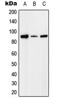 CFI / Complement Factor I Antibody - Western blot analysis of Factor I expression in HEK293T (A); Raw264.7 (B); PC12 (C) whole cell lysates.
