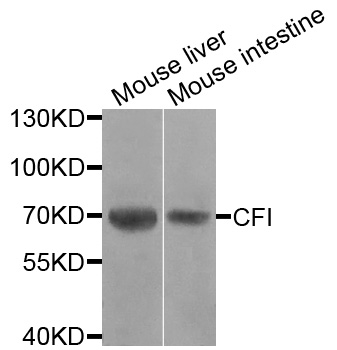 CFI / Complement Factor I Antibody - Western blot analysis of extracts of various cells.