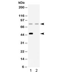 CFI / Complement Factor I Antibody