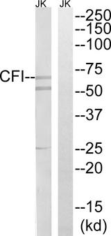 CFI / Complement Factor I Antibody - Western blot analysis of extracts from Jurkat cells, using CFI antibody.