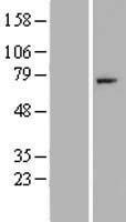 CFI / Complement Factor I Protein - Western validation with an anti-DDK antibody * L: Control HEK293 lysate R: Over-expression lysate