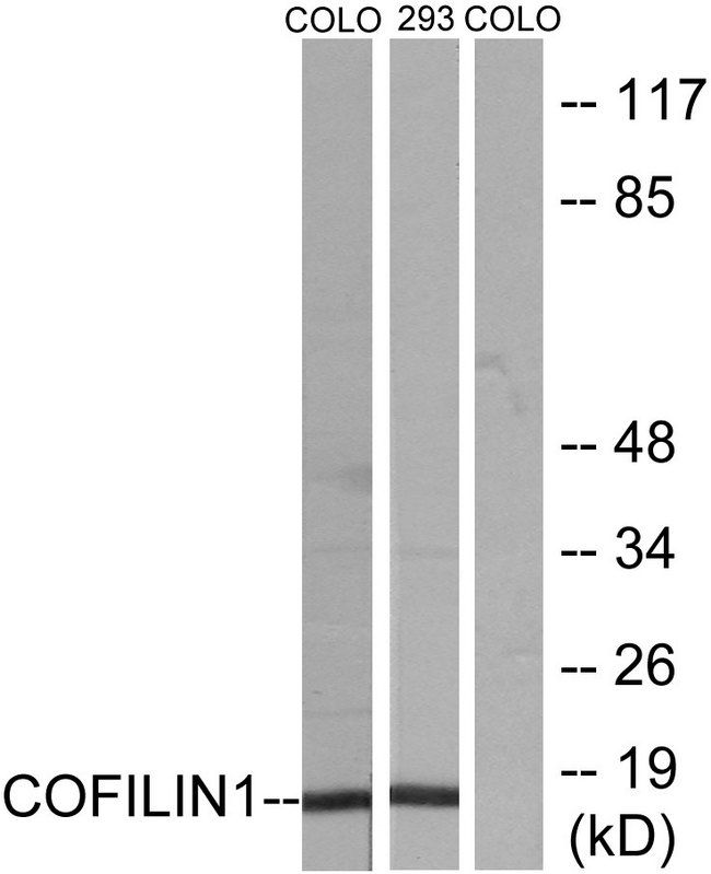 CFL1 / Cofilin Antibody - Western blot analysis of lysates from COLO205 and 293 cells, using Cofilin Antibody. The lane on the right is blocked with the synthesized peptide.