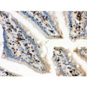 CFL1 / Cofilin Antibody - Cofilin antibody IHC-paraffin. IHC(P): Mouse Intestine Tissue.