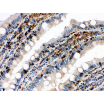 CFL1 / Cofilin Antibody - Cofilin antibody IHC-paraffin. IHC(P): Rat Intestine Tissue.