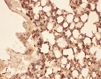 CFL1 / Cofilin Antibody - IHC-P testing of mouse lung tissue