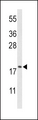 CFL1 / Cofilin Antibody - Western blot of CFL1 Antibody in HL-60 cell line lysates (35 ug/lane). CFL1 (arrow) was detected using the purified antibody;
