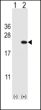 CFL1 / Cofilin Antibody - Western blot of CFL1 (arrow) using rabbit polyclonal CFL1 Antibody. 293 cell lysates (2 ug/lane) either nontransfected (Lane 1) or transiently transfected (Lane 2) with the CFL1 gene.