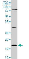 CFL1 / Cofilin Antibody - CFL1 monoclonal antibody (M04), clone 1A1. Western blot of CFL1 expression in Raw 264.7.