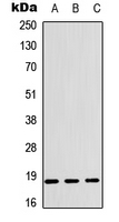 CFL1 / Cofilin Antibody - Western blot analysis of Cofilin expression in K562 (A); SHSY5Y (B); rat muscle (C) whole cell lysates.